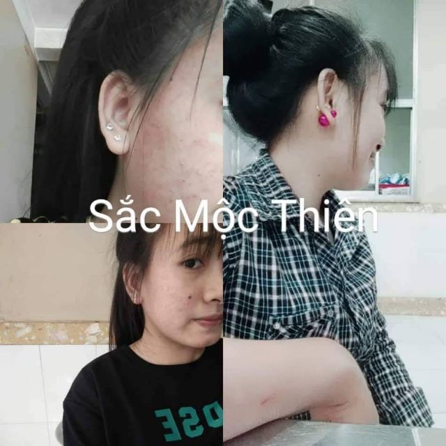 XÓA MỤN THÂM NÁM CÙNG TÁI TẠO DA SẮC MỘC-THIÊN