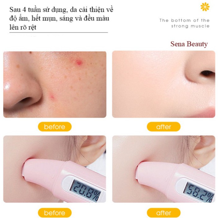 Nước thần hoa cúc Calendula Moisturizing Essence Water Maigoole 200ML Sena Beauty | BigBuy360 - bigbuy360.vn