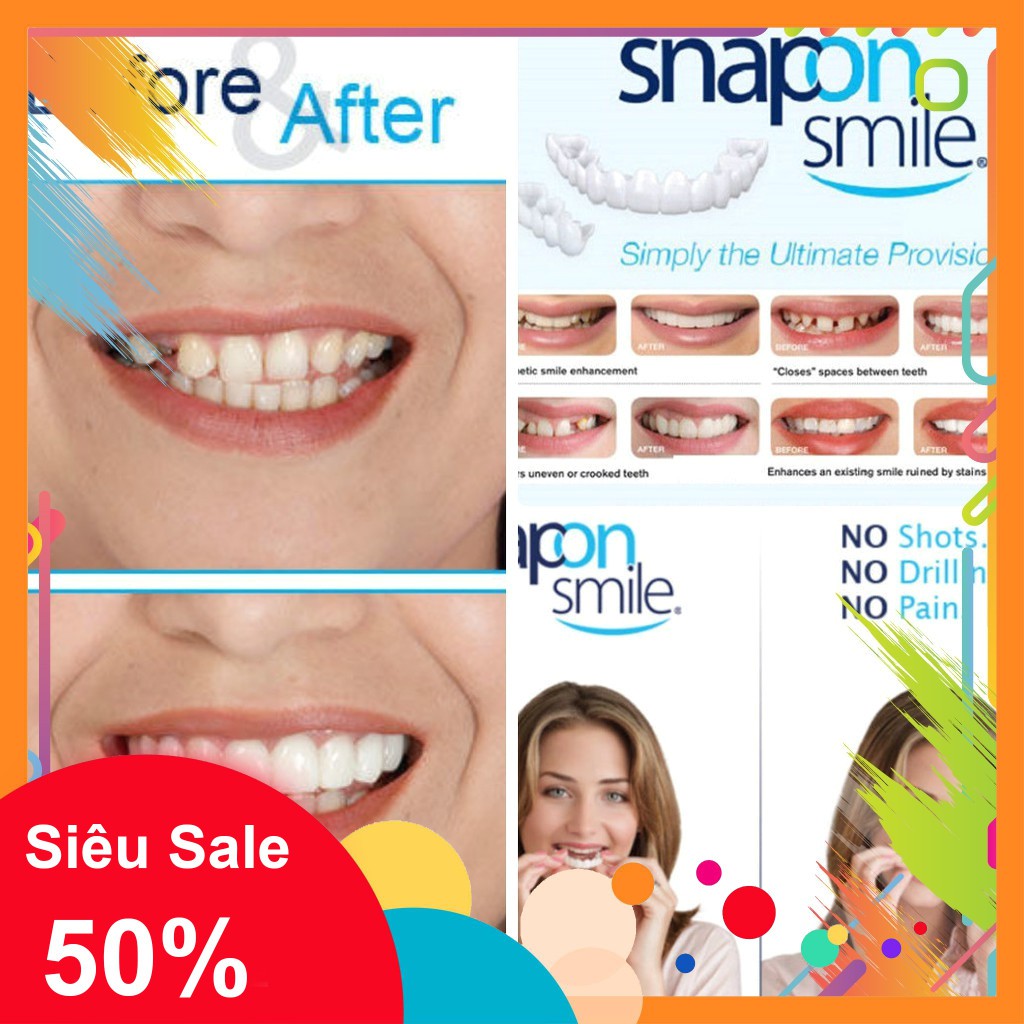 [GIÁ SẬP SÀN] RĂNG GIẢ SNAP ON SMILE [SỈ]