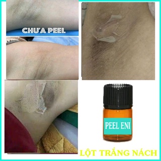 Lột Thay Da Nách Xóa Thâm Hết Sạm Mịn Da