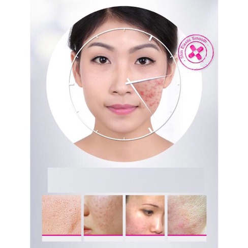 Kem Mụn Bioaqua Pure Skin Hàng Nội Địa Trung | BigBuy360 - bigbuy360.vn
