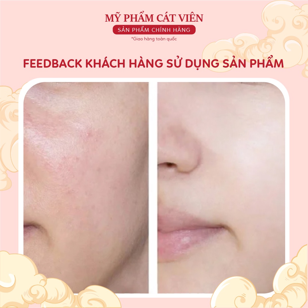 Tế Bào Gốc Trắng Da, Cang Bóng Da Mặt, Kiềm Dầu Da Dầu DNA Cá Hồi Medicell - lọ 5ml