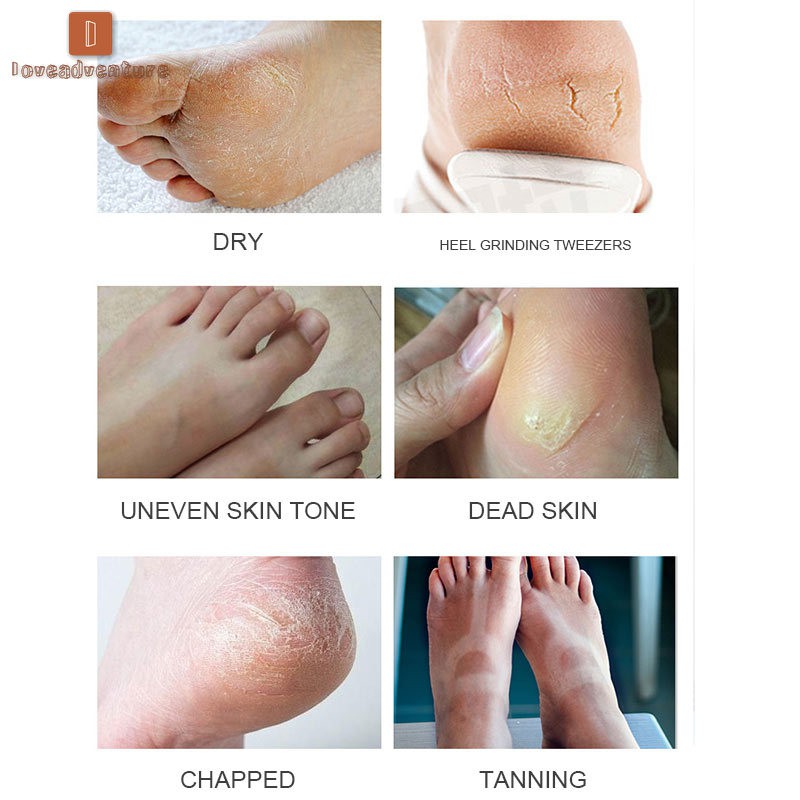 Mặt nạ ủ bàn chân tẩy da chết hiệu quả | BigBuy360 - bigbuy360.vn