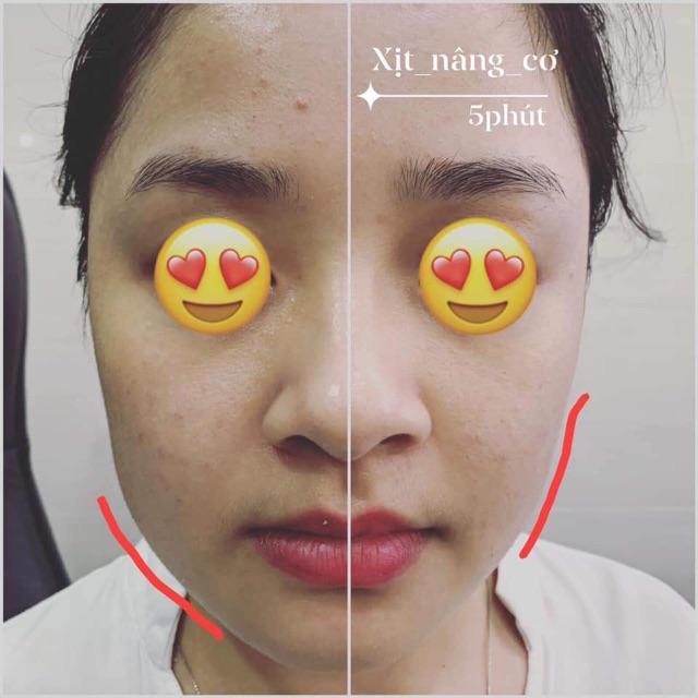 Xịt nâng cơ Lio nâng cơ ngay sau khi xịt | BigBuy360 - bigbuy360.vn