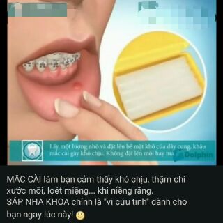 Sáp nha khoa 3M Unitek ( mỹ )