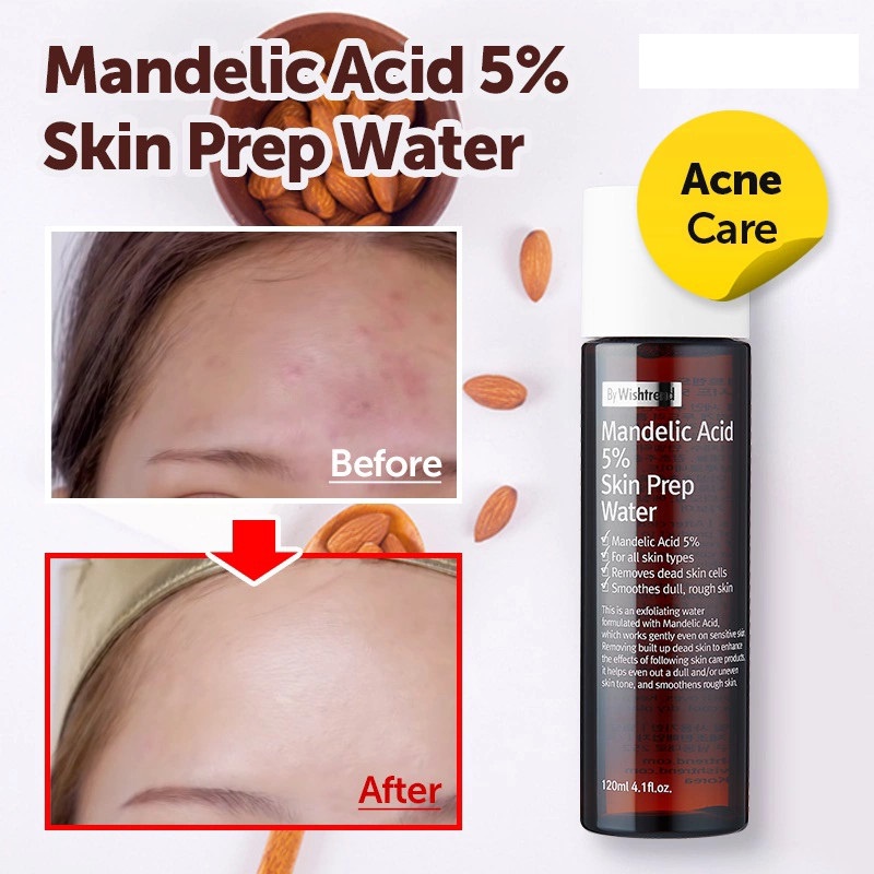 Dung Dịch Tẩy Da Chết Hoá Học Thanh Lọc Lỗ Chân Lông By Wishtrend Mandelic Acid 5% Skin Prep Water 120ml | BigBuy360 - bigbuy360.vn