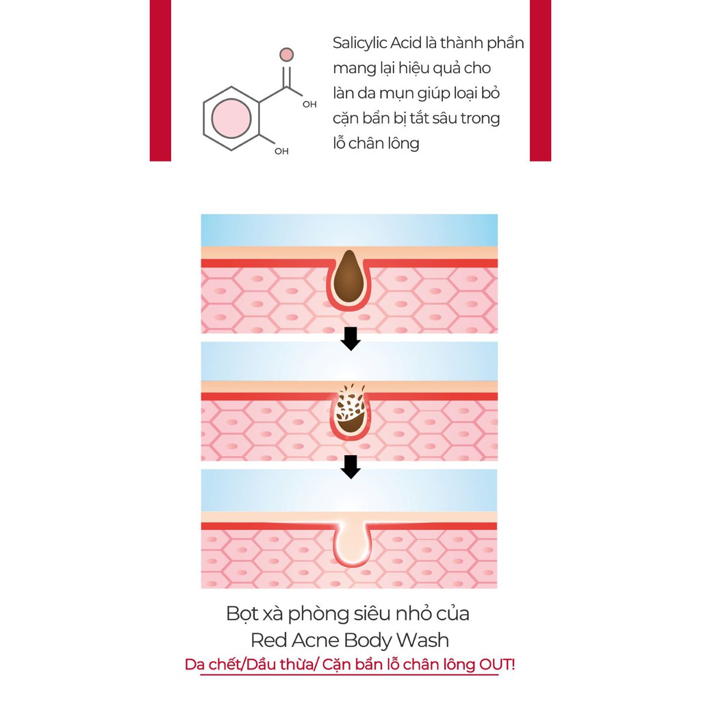 Sữa Tắm Cho Da Mụn Medicube Red Acne Body Wash 400ml _ Medicube Chính Hãng