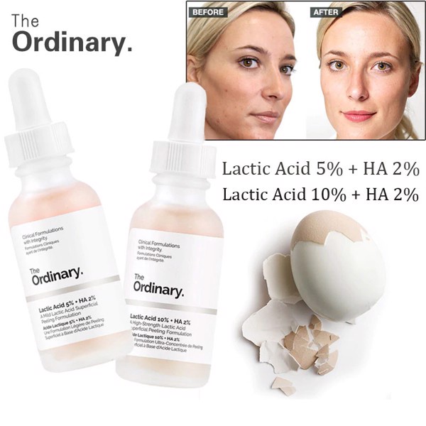 ✅[CHÍNH HÃNG] Tinh Chất Tẩy Da Chết Hóa Học The Ordinary Lactic Acid 5% + HA &amp; Latic Acid 10% + HA