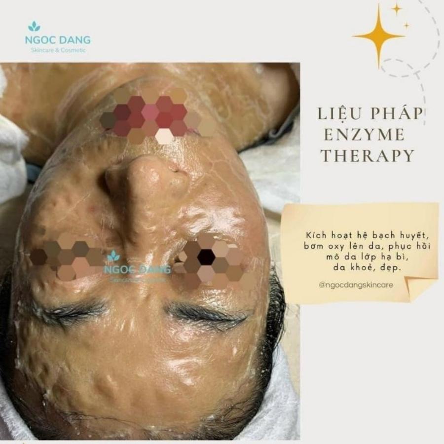 Bộ Enzyme therapy tái tạo da DMK