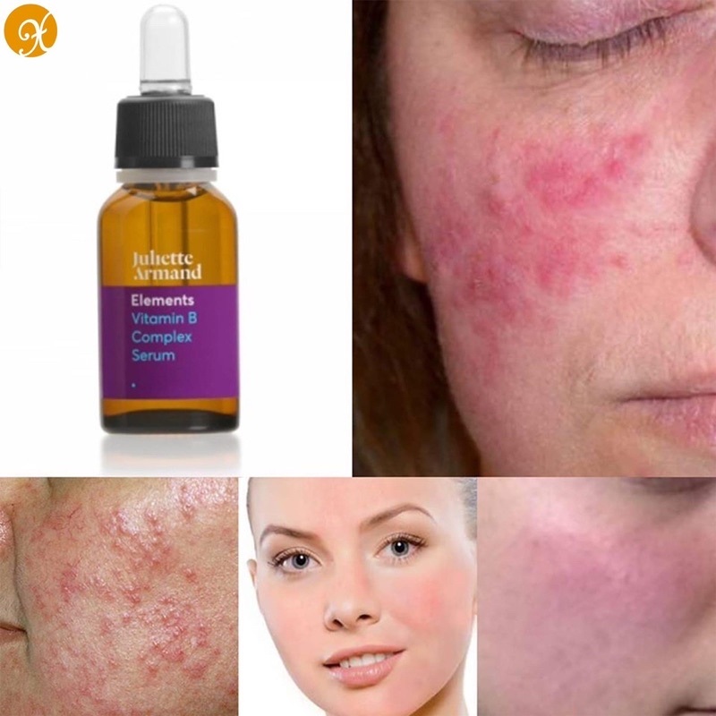 [Chính Hãng CTY] 𝐒𝐞𝐫𝐮𝐦 𝐁𝟗 𝐉𝐮𝐥𝐢𝐞𝐭𝐭𝐞 𝐀𝐫𝐦𝐚𝐧𝐝 ( Folic Acid ) - siêu phẩm phục hồi tái tạo da