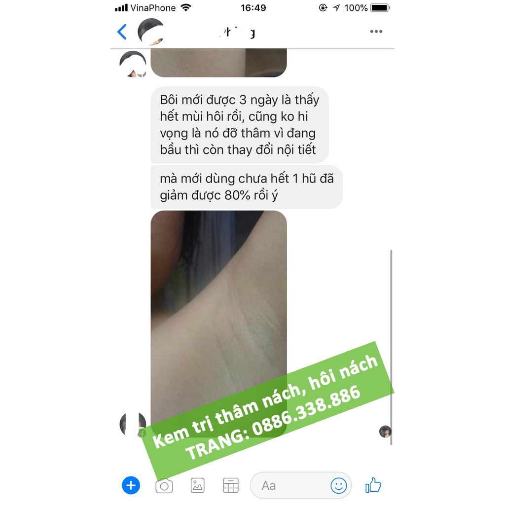 Kem khử thâm nách hôi nách handmade | BigBuy360 - bigbuy360.vn