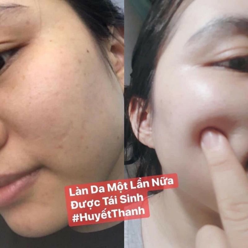 Serum HUYẾT_THANH_TRUYỀN_TRẮNG 7D_OLIC chính hãng 100%
