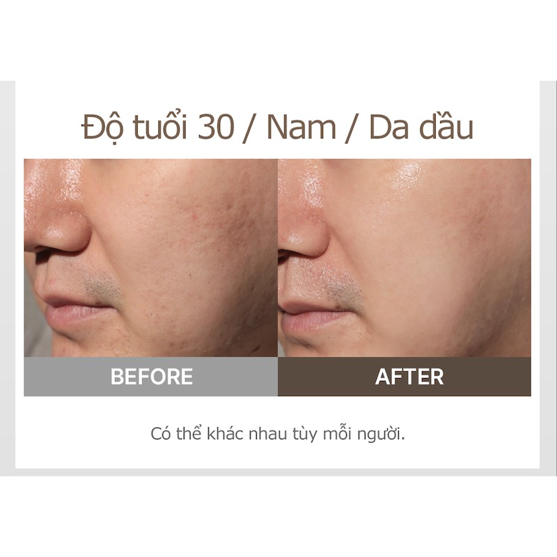 Gel Tẩy Tế Bào Chết ACSYS Peeling Gel