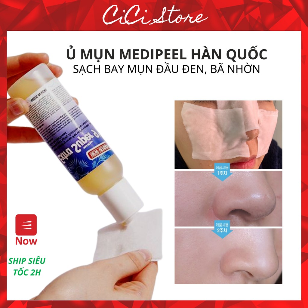 Dung dịch ủ mụn đầu đen Medi-peel extra super 9 plus Medipeel 100ml