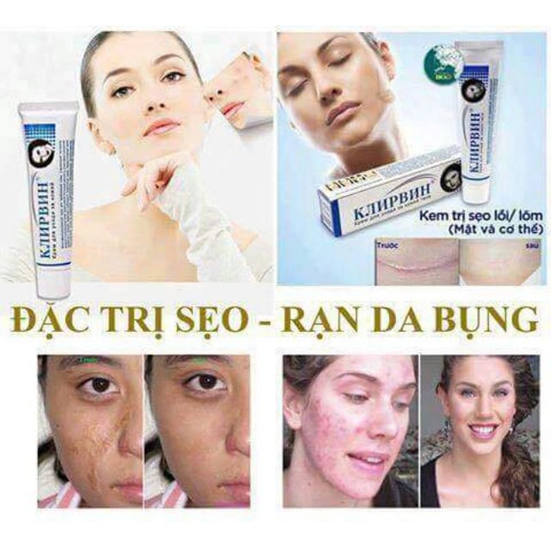✔️[100% Chính Hãng] Kem Xóa Sẹo Nga Klirvin, Kem Xóa Thâm, Xóa Sẹo, Tái Tạo Làn Da | BigBuy360 - bigbuy360.vn