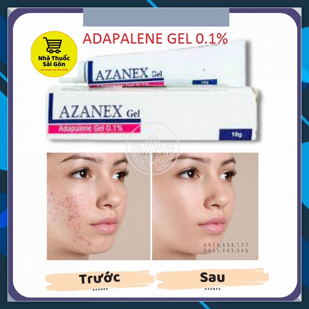 Adapalene Gel 0 1 -  AZANEX Gel 0 1 Ấn Độ Chính hãng - Bôi Mụn cùng công thức với Differin gel 0 1