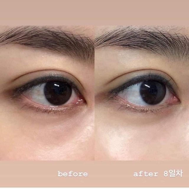 🔆Kem Mắt từ TRỨNG CÁ HỒI Salmon energy Eye Cream của hãng Charmzone Hàn Quốc sử dụng được cho vùng mắt và cả mặt