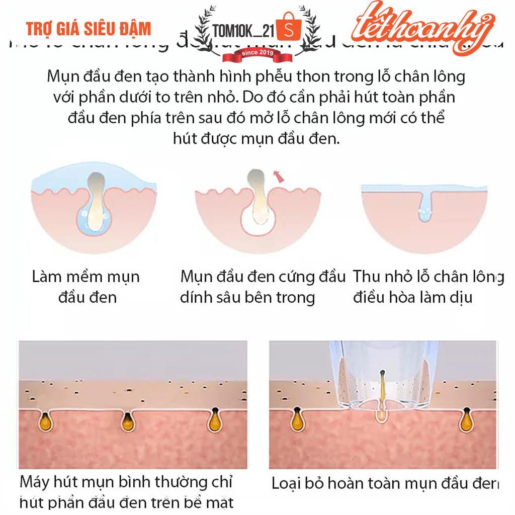 Máy hút mụn trứng cá - bản Quốc Tế