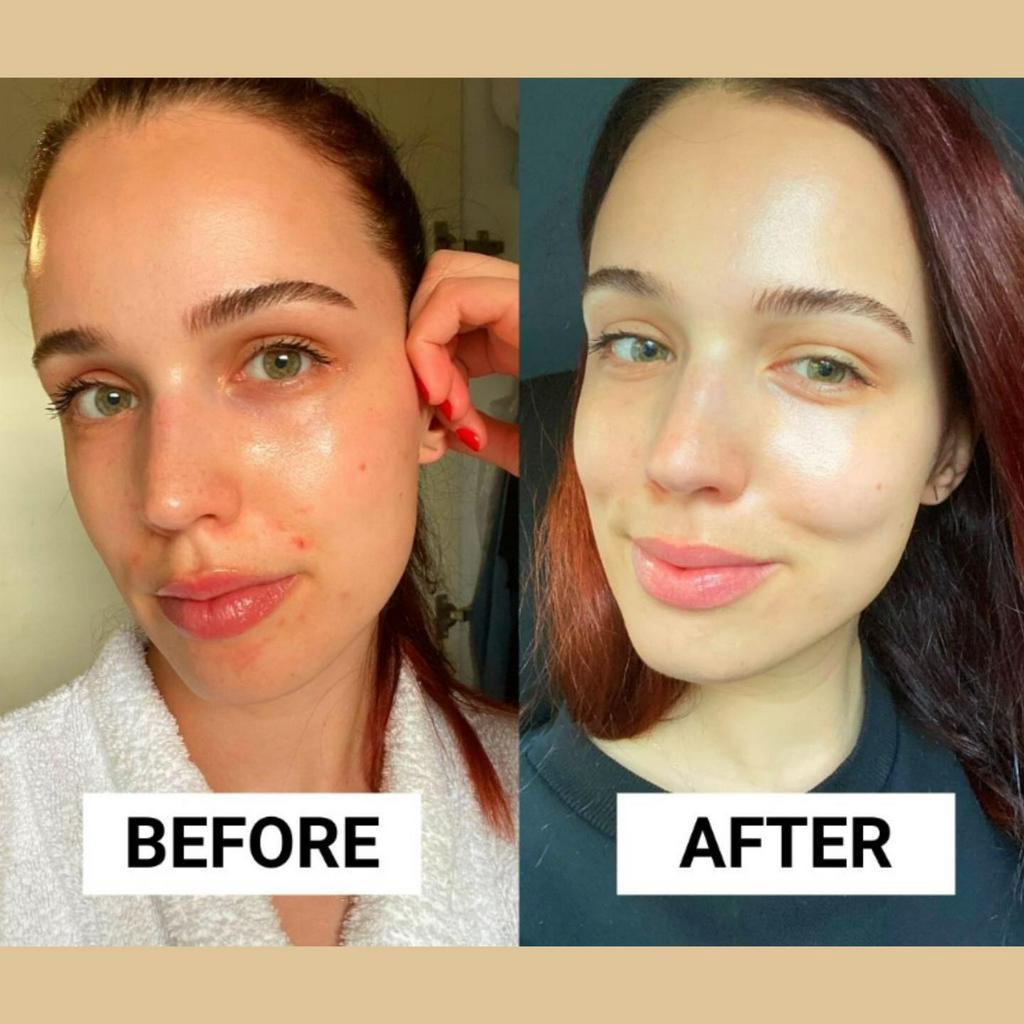 Tinh chất La Roche-Posay Retinol B3 Serum 30ml
