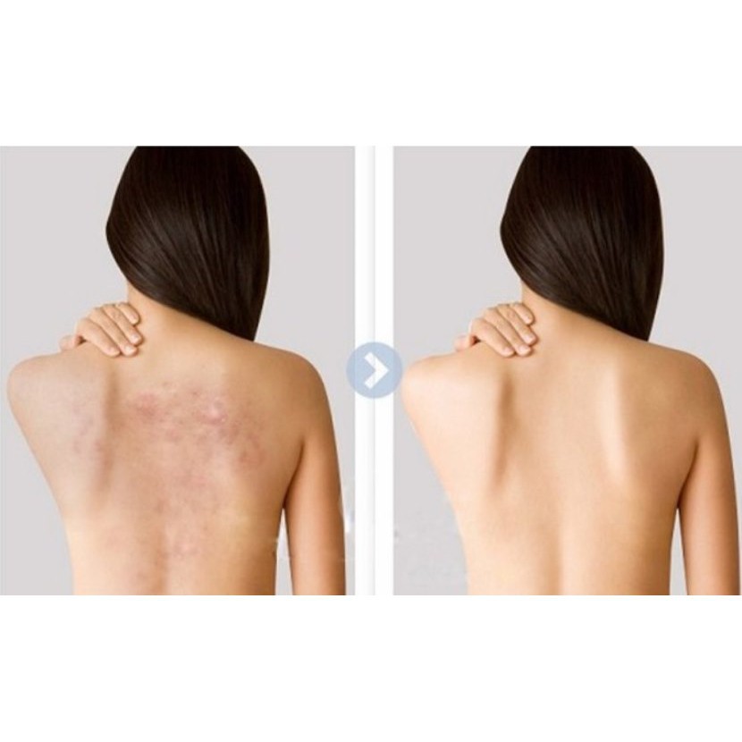 Sữa tắm làm sạch mụn cơ thể Mario Badescu A.H.A Botanical Body Soap | BigBuy360 - bigbuy360.vn