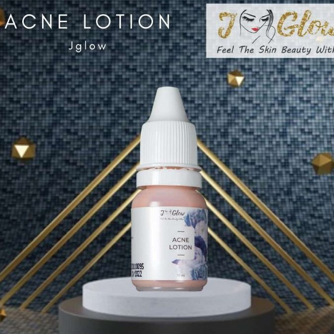 (Hàng Mới Về) Lotion Trị Mụn Làm Trắng Da Jglow