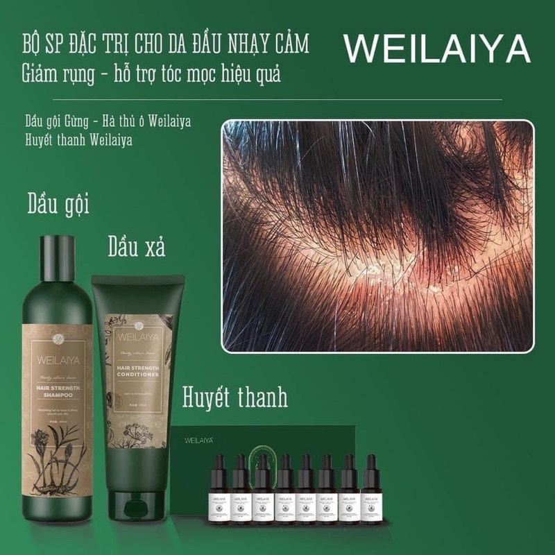 Bộ dầu gội gừng Weilaiya, tinh chất hà thủ ô và gừng tươi, hỗ trợ mọc tóc, ngăn rụng tóc,