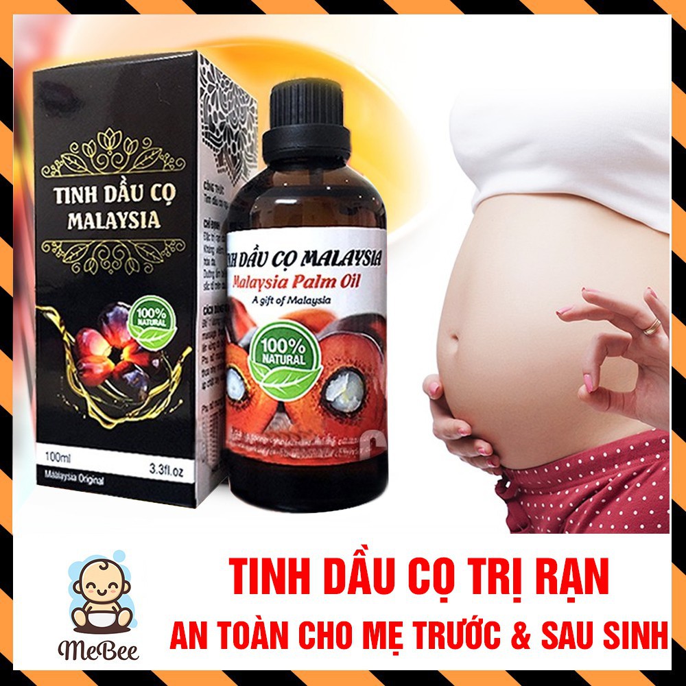 Tinh Dầu Cọ Trị Rạn Da Malaysia An Toàn Cho Mẹ Trước và Sau Sinh No.1