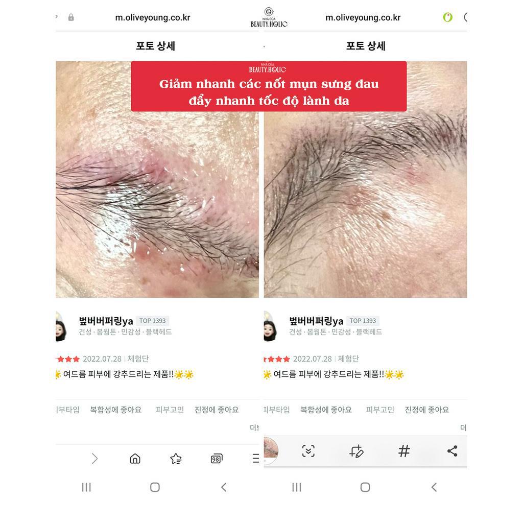 Dòng sản phẩm chăm sóc chuyên sâu cho da mụn DR.G A'CLEAR