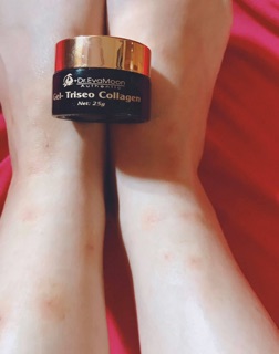Cao sẹo collagen