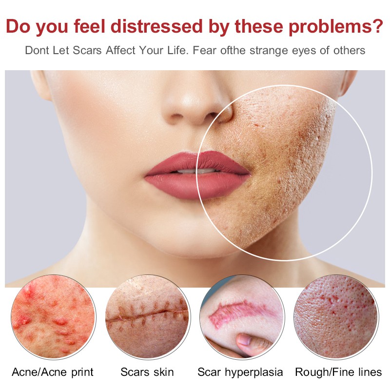 Toner VIBRANT GLAMOUR hỗ trợ giảm sẹo do mụn giảm vết rạn da cấp ẩm không gây nhờn dính phù hợp với mọi loại da 40ml | BigBuy360 - bigbuy360.vn