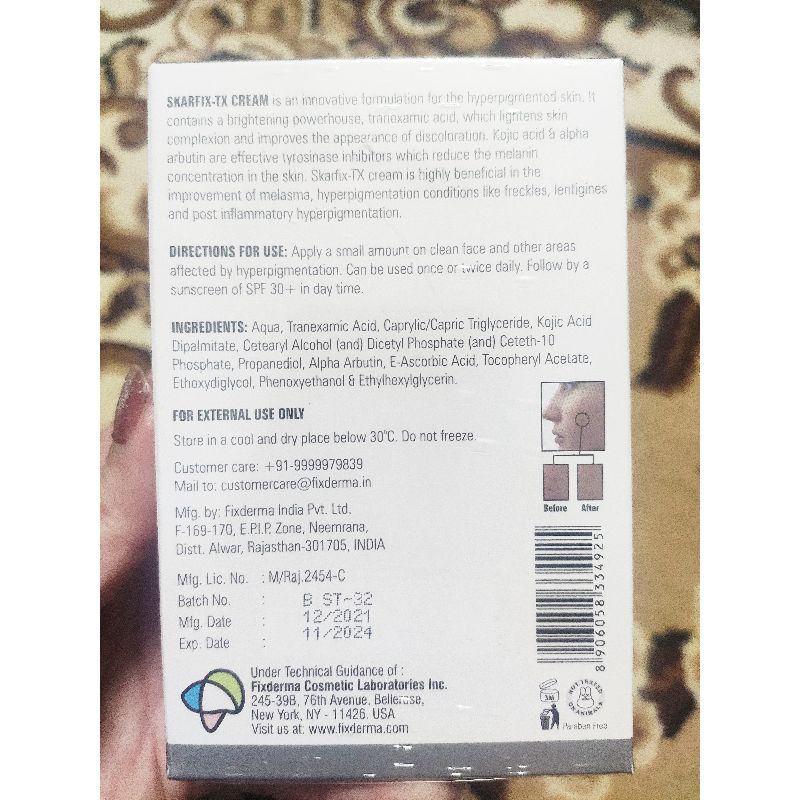Kem Skarfix - TX 15g mờ thâm mụn, mờ nám tàn nhang, giúp sáng da sáng mịn và đều màu 💋💋 | BigBuy360 - bigbuy360.vn