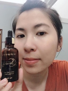 Thuốc đong y sắc mộc lan