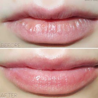 Tẩy Da Chết Môi Beauty Treats Lips Scrub (10.5gr)
