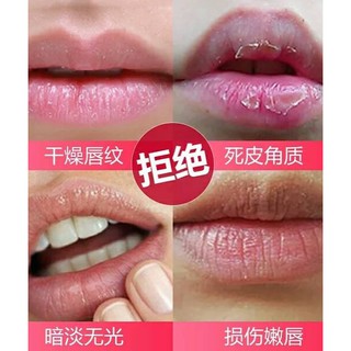 💋MẶT NẠ MÔI BIOAQUA💋( China)