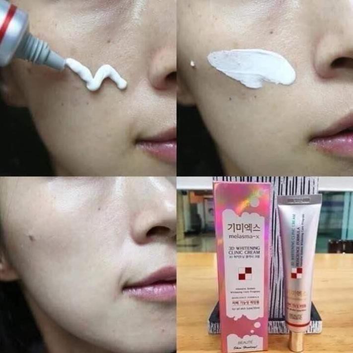 Kem Trắng Da Mờ Nám Tàn Nhang MELASMA-X 3D WHITENING CLINIC - CREAM Hàn Quốc 35ml giúp mờ thâm nám trắng sáng tự nhiên