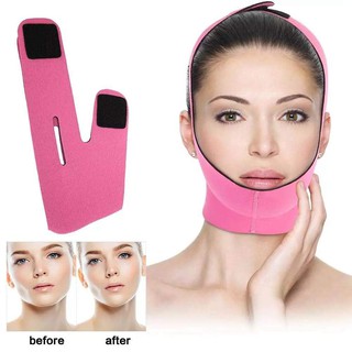 Miếng dán nâng cằm vline, nâng cơ mặt