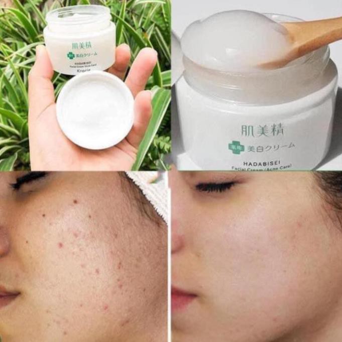 nam2k6ahihi Kem Dưỡng Ngăn Ngừa Mụn và Dưỡng Trắng Kracie Hadabisei Acne -Mỹ Phẩm Nhật Nôi Đia AyakaShop. Ma20s