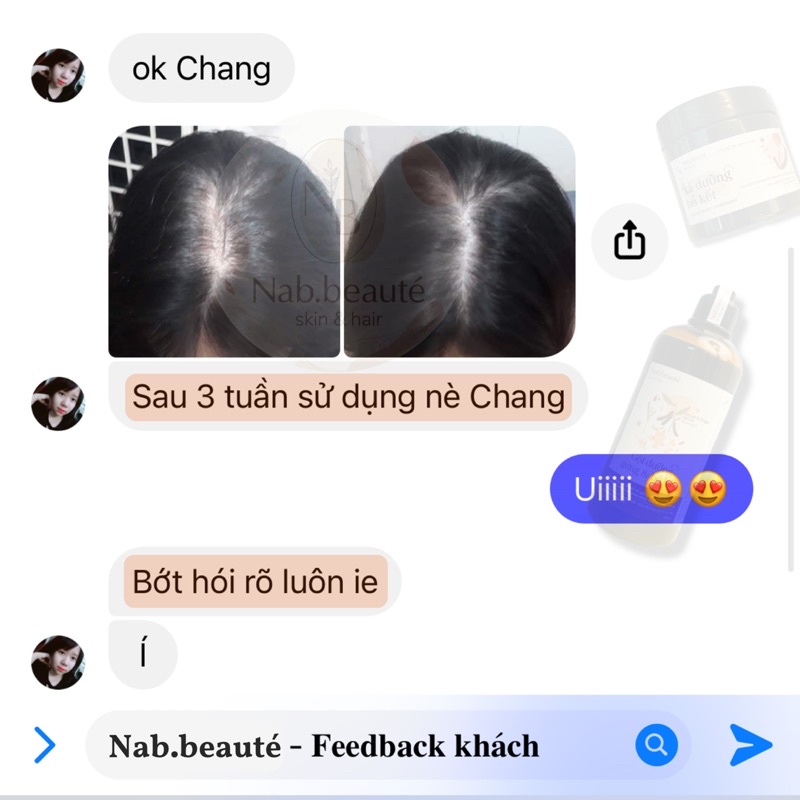 [TIẾT KIỆM 60k] Combo 3chai Dầu Gội Thảo Dược Gừng Bồ Kết 300ml
