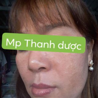 MỸ PHẨM THANH DƯỢC (SERUM LÁRE LỌ 80ML)