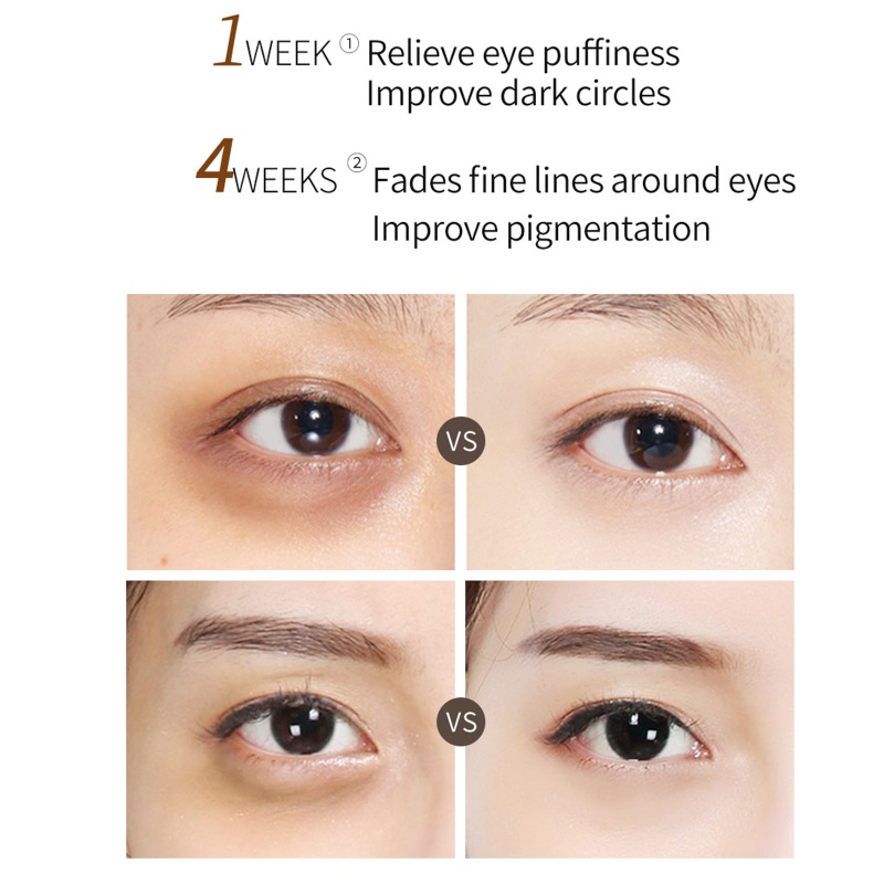 Kem Dưỡng Da Mắt YOUYO Cấp Ẩm Làm Sáng Da 0 7 fl oz Cr