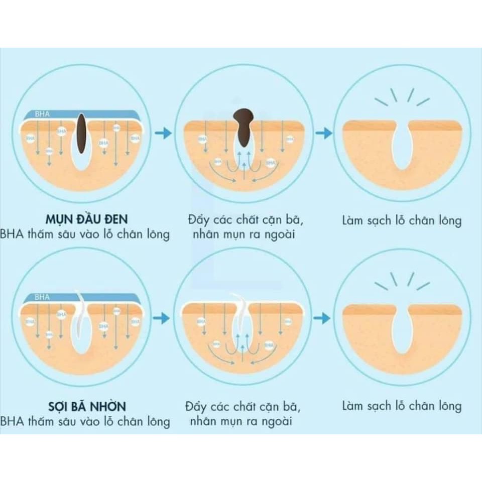 Tinh chất se lỗ chân lông PORE TREATMENT | BigBuy360 - bigbuy360.vn