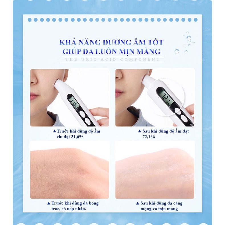 Xịt khoáng IMAGES hoa tuyết dưỡng ẩm kiềm dầu 150ml nội địa Trung cao cấp | BigBuy360 - bigbuy360.vn