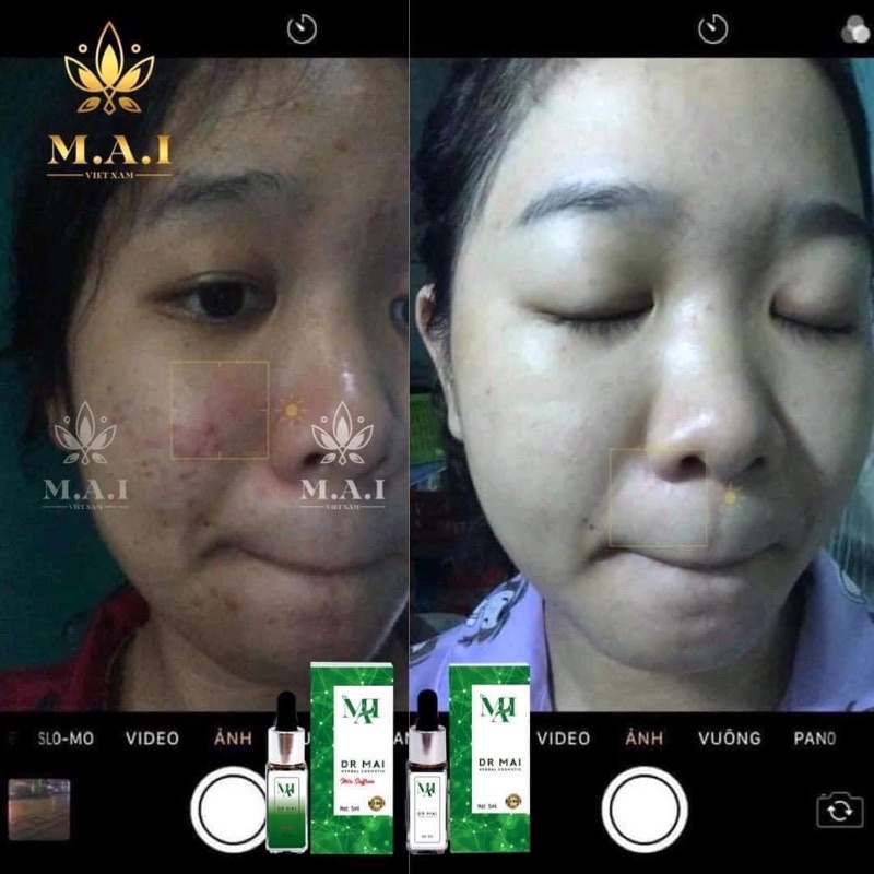 [CHÍNH HÃNG]DR MAI NGUYÊN CHẤT CHUYÊN MỤN NẶNG/PHỤC HỒI DA HƯ TỔN | BigBuy360 - bigbuy360.vn