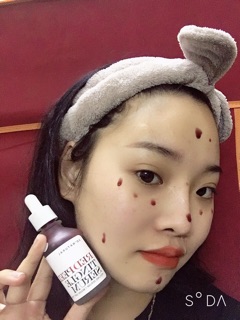 Redpeel serum fullsize và chiết 10ml