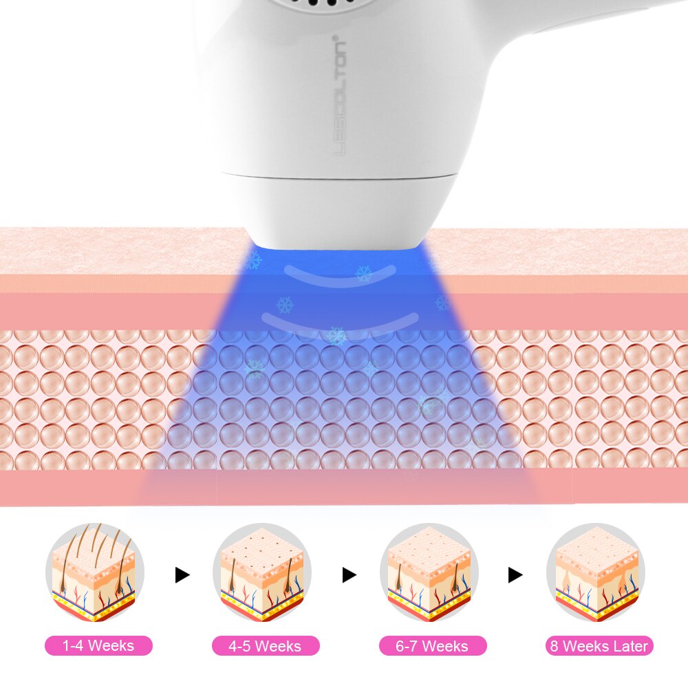 Máy Tẩy Lông T011C Lescoton IPL Laser Dành Cho Nữ