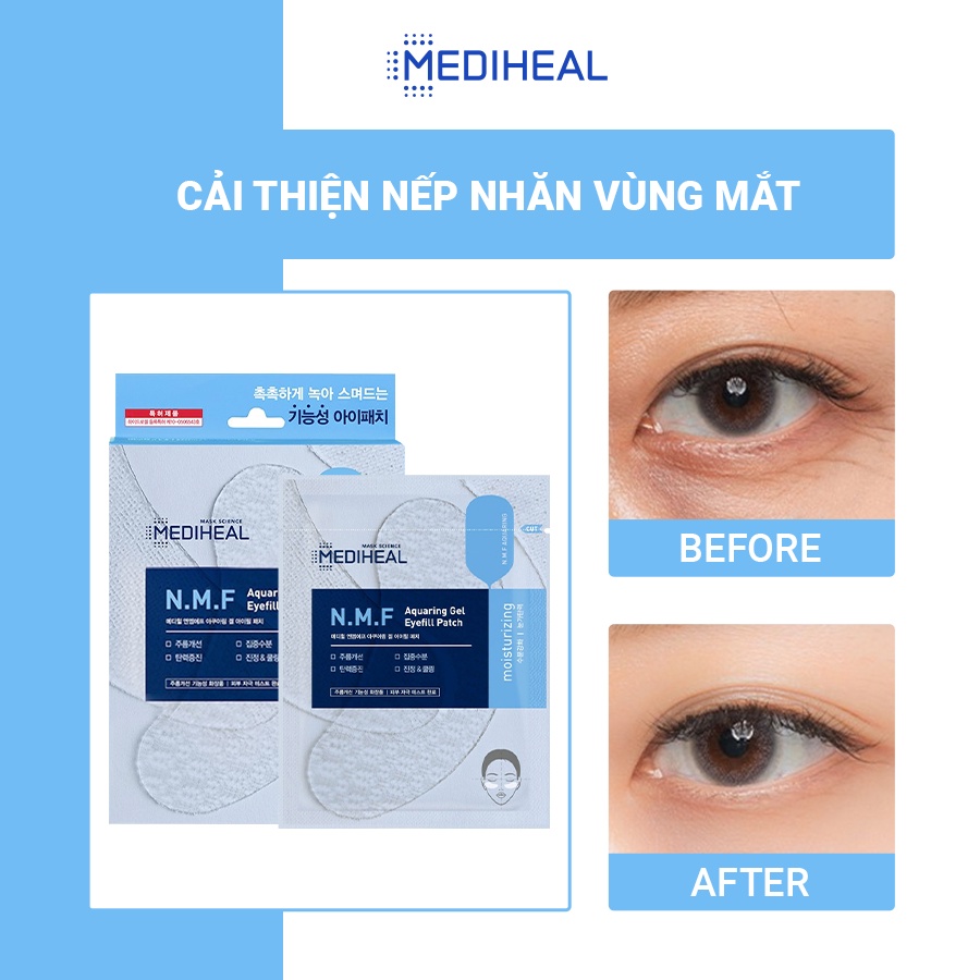 Mặt Nạ Cấp Ẩm Cho Mắt Mediheal N.M.F Aquaring Gel Eye Fill Patch Hộp 5 Túi [K32]