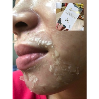Peel da retinol vi tảo - trang nemo.