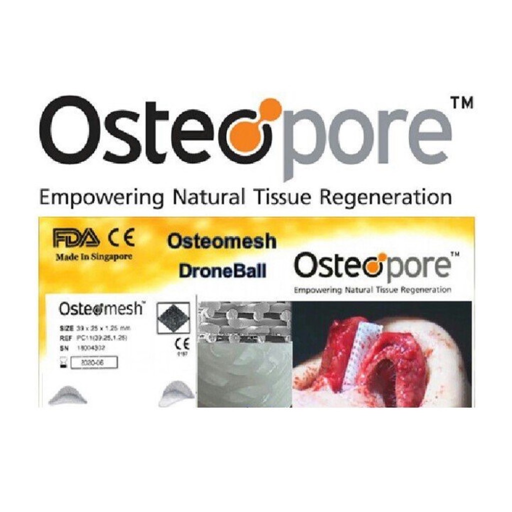 TRỤ MŨI VÁCH NGĂN OSTEO PORE