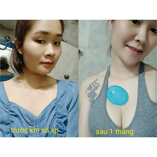 XÀ PHÒNG NỞ NGỰC