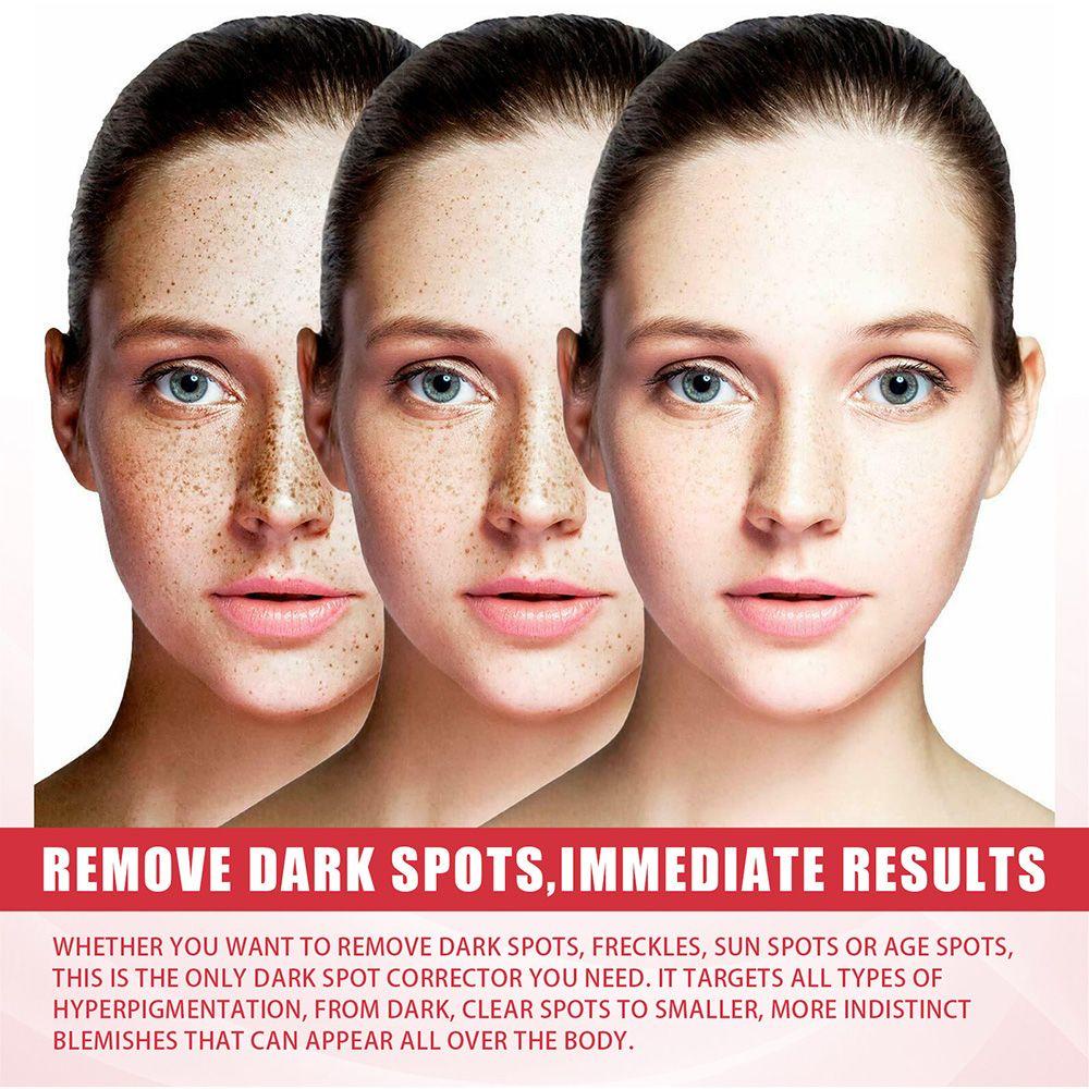 Kem Dưỡng Ẩm Làm Trắng Da Kojic Acid 3 Ngày